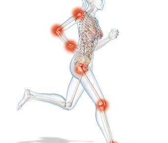 Frauen Zeichnung mit Arthrose