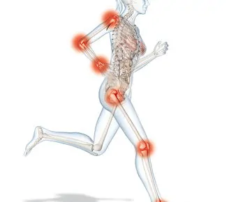 Frauen Zeichnung mit Arthrose