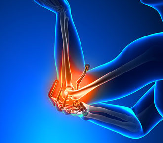 Schmerzen im Ellenbogen