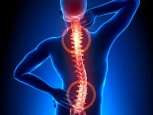 Mann mit Rückenschmerzen (Röntgenaufnahme)