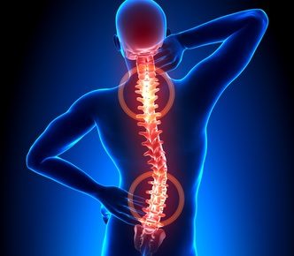 Mann mit Rückenschmerzen (Röntgenaufnahme)