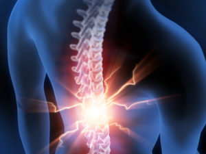 Wirbelkörperfraktur