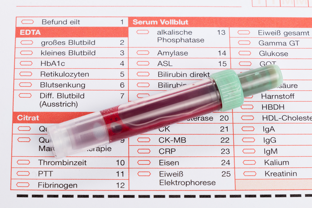 Blutwerte Ratgeber - Was man zu einer Blutuntersuchung wissen sollte